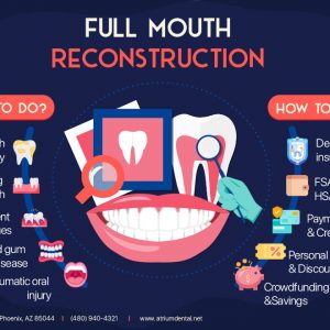 unlock the secrets of full mouth reconstruction with insurance discoveries and insights unveiled