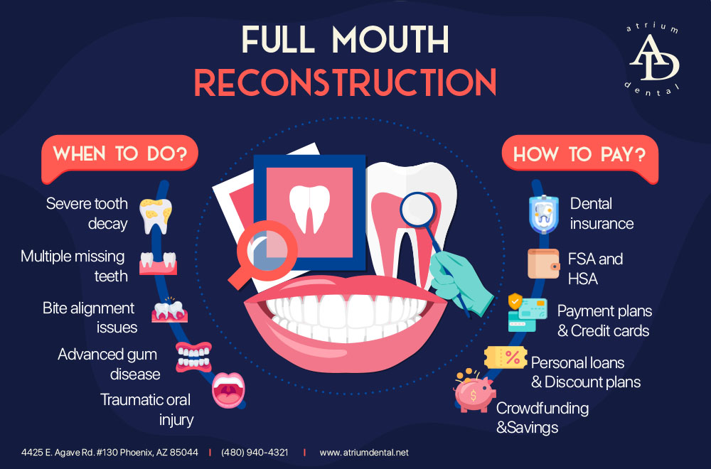 unlock the secrets of full mouth reconstruction with insurance discoveries and insights unveiled